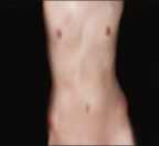 Nudes