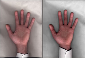 Retouching Samples